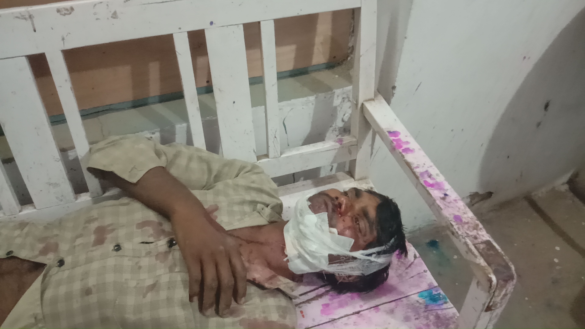 अंजड़ बाइक सवार खड़ी कार में घुसा पती पत्नी घायल