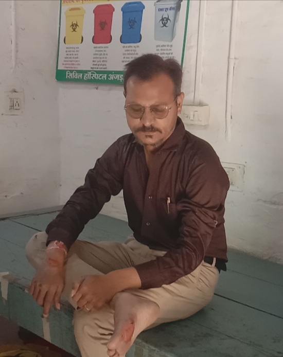 अंजड़ पारिख गोल्डन ट्रांसपोर्ट की गाड़ी का रसा खुलने से दो पहिया वाहन में अटका चालक लखन परमार निवासी अंजड़  गिरने से हुआ घायल ट्रांसपोर्टर की बड़ी लापरवाही आई सामने