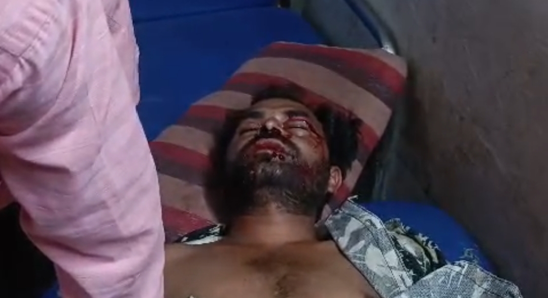 अलीराजपुर जिले का नानपुर स्वास्थ केंद्र  भगवान भरोसे  जिम्मेदार डाक्टरो की मनमानी से आम जनता परेशान नवागत कलेक्टर से कार्यवाही की मांग