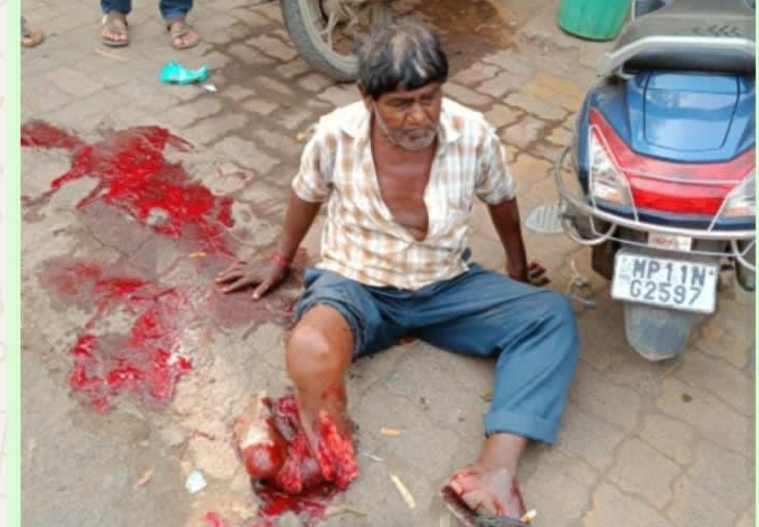 मनावर ओवर लोड अनियंत्रित  सीमेंट के ट्राले  ने गांधी चौराहे पर गुरुवार की सुबह  एक बुजुर्ग को टक्कर मारदी, जिससे बुजुर्ग का पांव बुरी तरह कुचल गया घटना के बाद जनता में आक्रोश